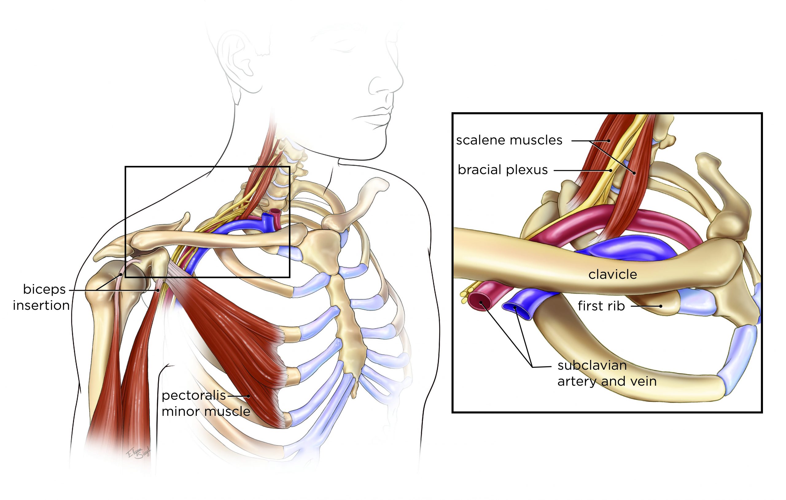 Anatomy Of Thoracic Outlet Syndrome Vascular Thoracic Outlet Syndrome Anatomy Of Thoracic Outlet Syndrome Vascular Thoracic Outlet Syndrome