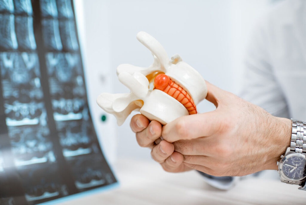Diagnosis, Symptoms & Treatment Options (1)