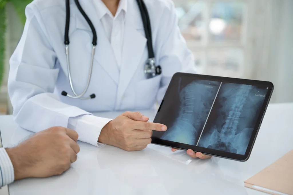 Herniated Thoracic Disc - Causes, Symptoms, Treatments (1)